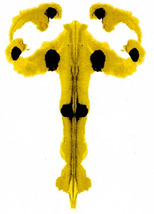 Bài trắc nghiệm tâm lý Hermann Rorschach Bài trắc nghiệm tâm lý Hermann Rorschach