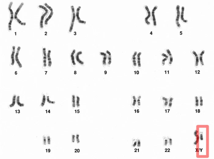 Nhiễm sắc thể