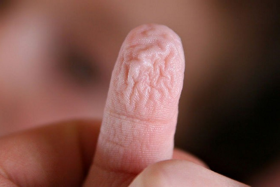 Ngón tay sẽ nhăn lại khi bị ngâm lâu trong nước.
