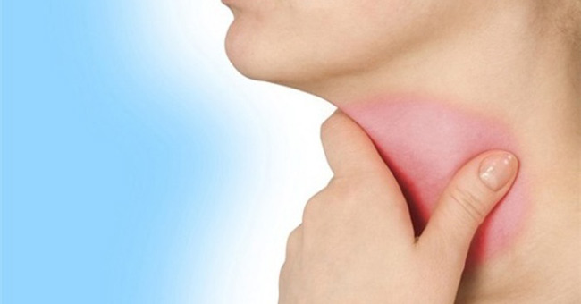 Cách chữa viêm họng hữu hiệu vào mùa đông